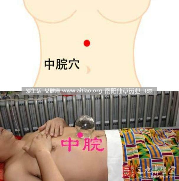 中脘穴位于腹部正中線，臍上4寸的位置上。每天艾灸10-15分鐘，能有效緩解胃部不適的癥狀，同時有助于祛濕。